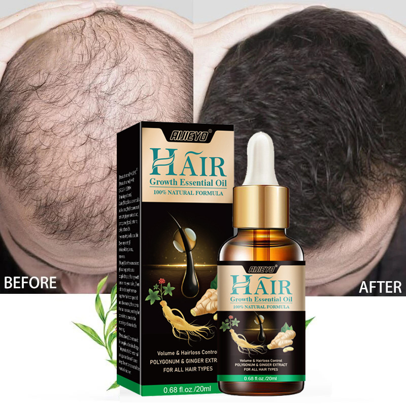 Licorice Root Sticks - 2023 Biotin minyak penumbuh rambut cepat,