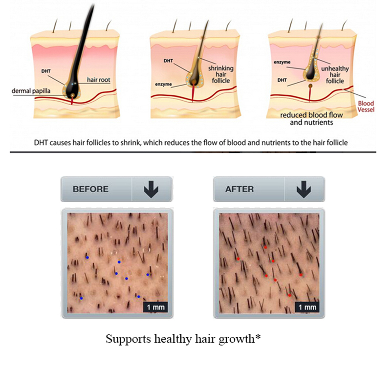 PURC sampo rambut rontok jahe, - Licorice Root Sticks ulasan dan harga